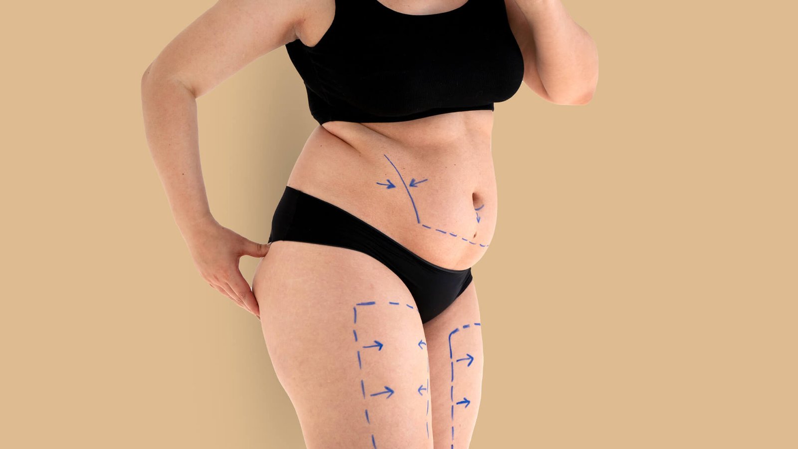 Mommy Makeover treatment