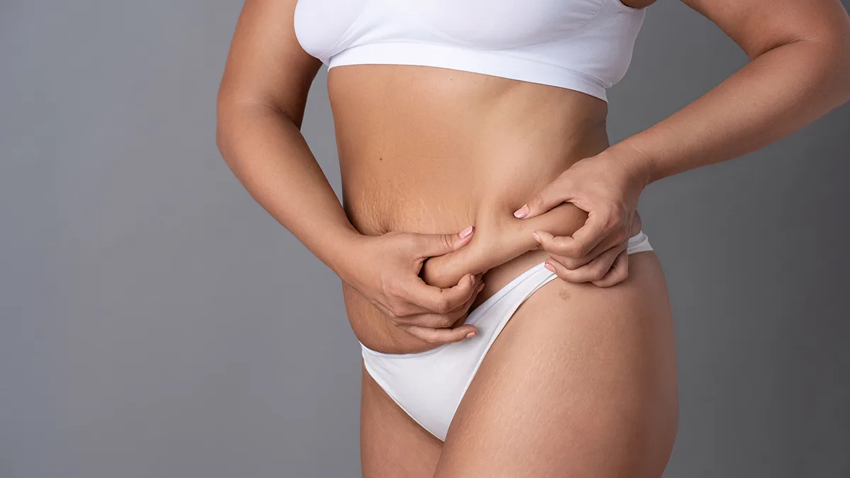 Tummy Tuck treatment